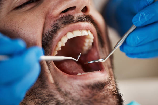 Best Emergency Dental Services for Seniors in Lochsloy, WA